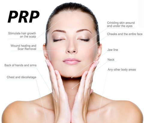 Platelet Rich Plasma Facial | PRP Vampire Facelift | Watford, Hemel, Herts